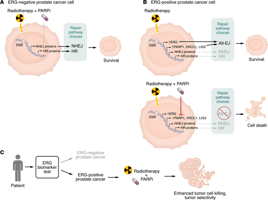ERG-driven DNA repair rewiring creates a therapeutic window for radiosen...