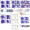 ST analysis reveals distinct immunocompetent regions associated with combin