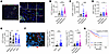 CD73 expression is associated with reduced CD8+ T cell infiltration and act