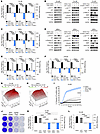 EZH2 and PI3K signaling pathway inhibitors synergize to kill advanced prost