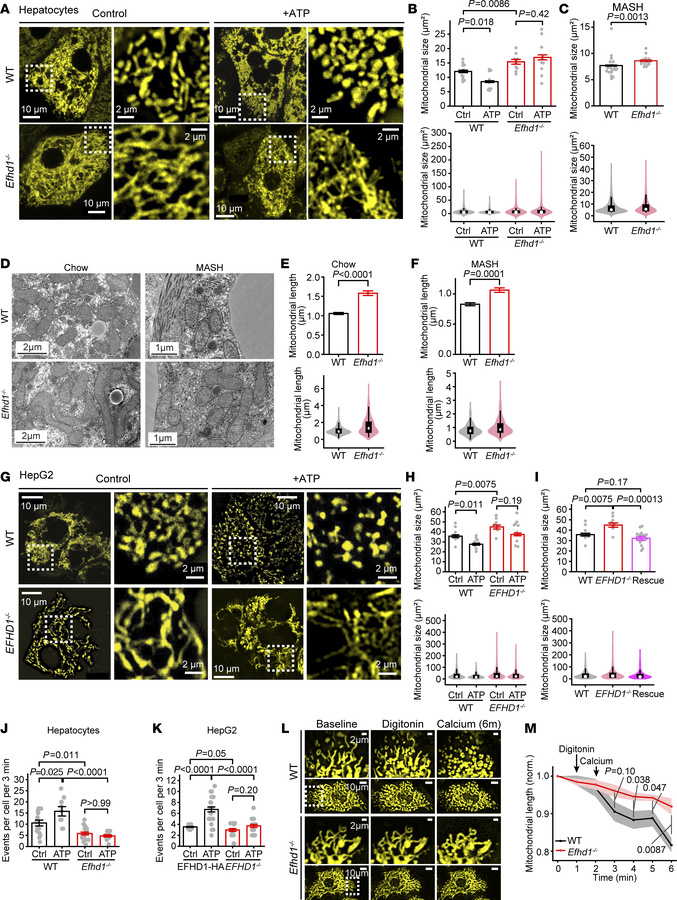 EFHD1 is necessary for Ca2+-induced mitochondrial remodeling.
(A) Repres...