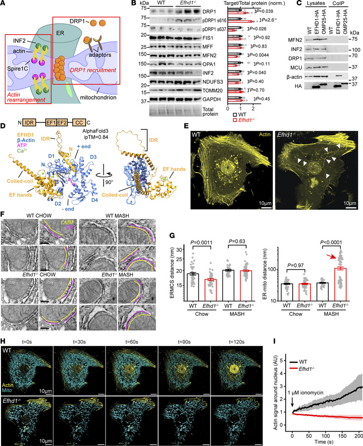 EFHD1 triggers Ca2+-dependent ERMCS stabilization.
(A) Important events ...