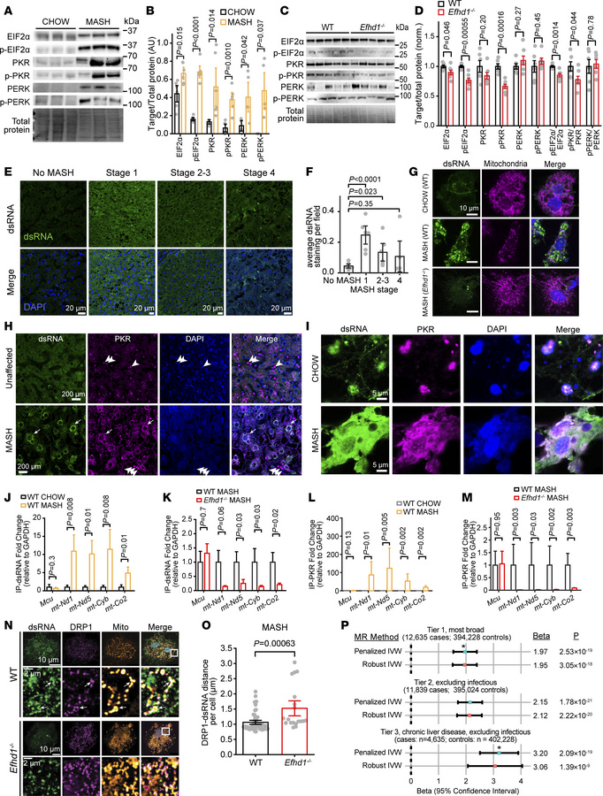 Excessive ERMCS stabilization triggers pathological mt-dsRNA release and...