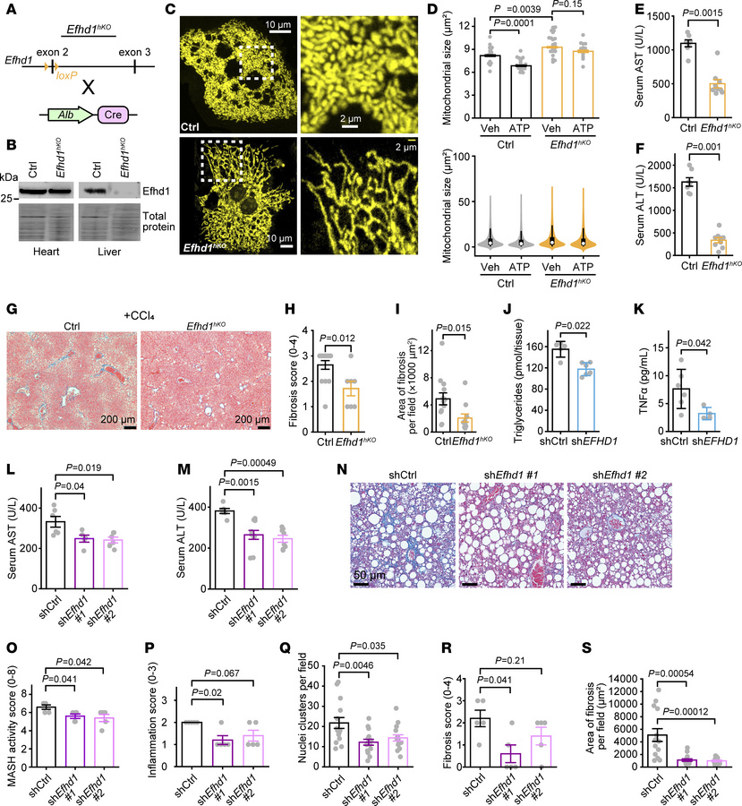 Liver-specific EFHD1 inhibition reduces hepatocyte injury.
(A) Hepatocyt...