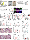 Loss of EFHD1 prevents hepatocyte injury in MASH.
