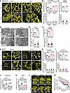 EFHD1 is necessary for Ca2+-induced mitochondrial remodeling.