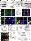 Excessive ERMCS stabilization triggers pathological mt-dsRNA release and a
