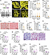 Liver-specific EFHD1 inhibition reduces hepatocyte injury.
