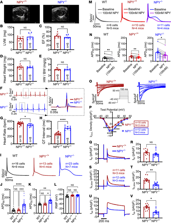 Congenital depletion of neuropeptide Y prolongs ventricular APD by disco...