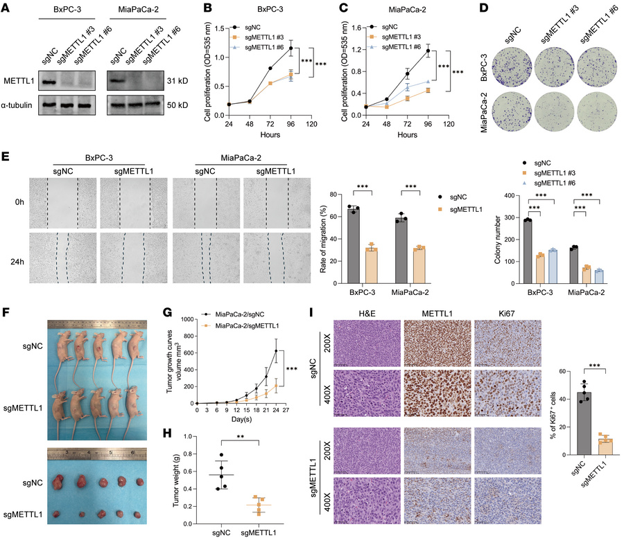 METTL1 promotes PDAC cell growth, migration, and tumorigenicity.
(A) MET...