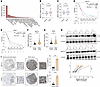 METTL1 is elevated in PDAC and correlates with a poor prognosis.