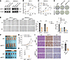 METTL1 promotes PDAC cell growth, migration, and tumorigenicity.