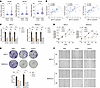 Valine tRNAs are upregulated in PDAC and are necessary for cancer cell grow