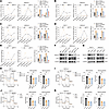METTL1/valine tRNA depletion impairs mitochondrial bioenergetics in PDAC ce