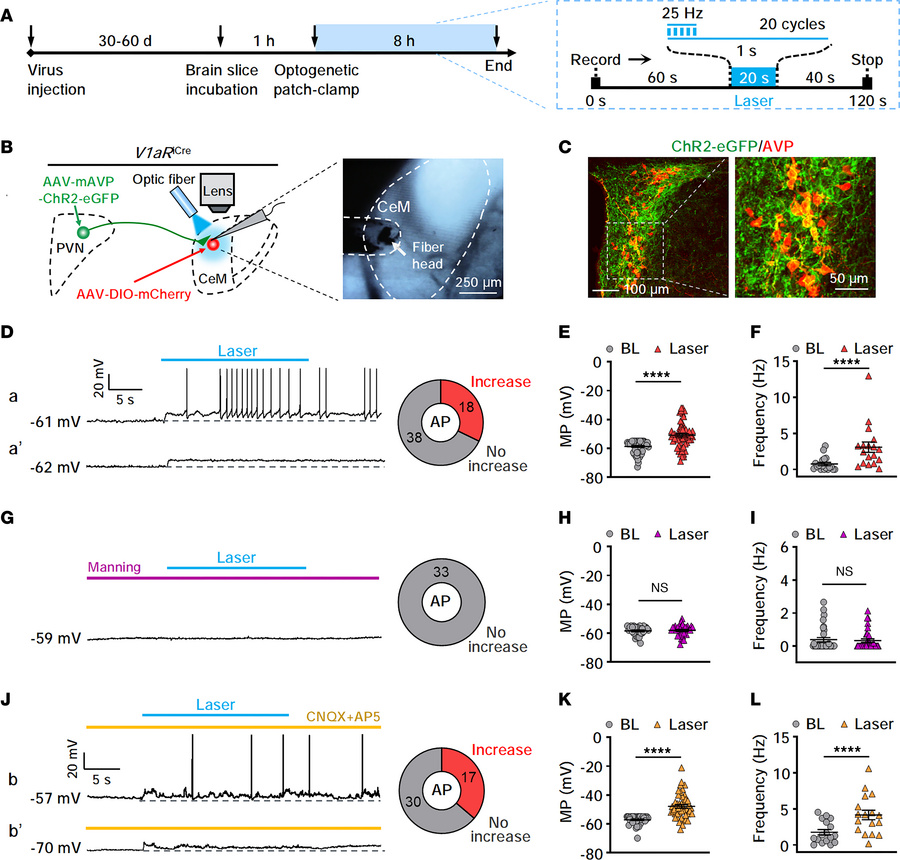 Direct activation of CeMV1aR neurons by AVP release from the PVN.
(A) Ti...