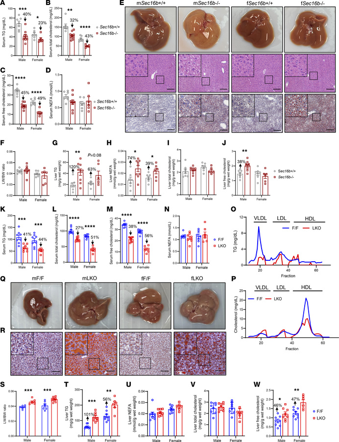 Loss of Sec16b reduces serum lipids and leads to hepatic lipid accumulat...