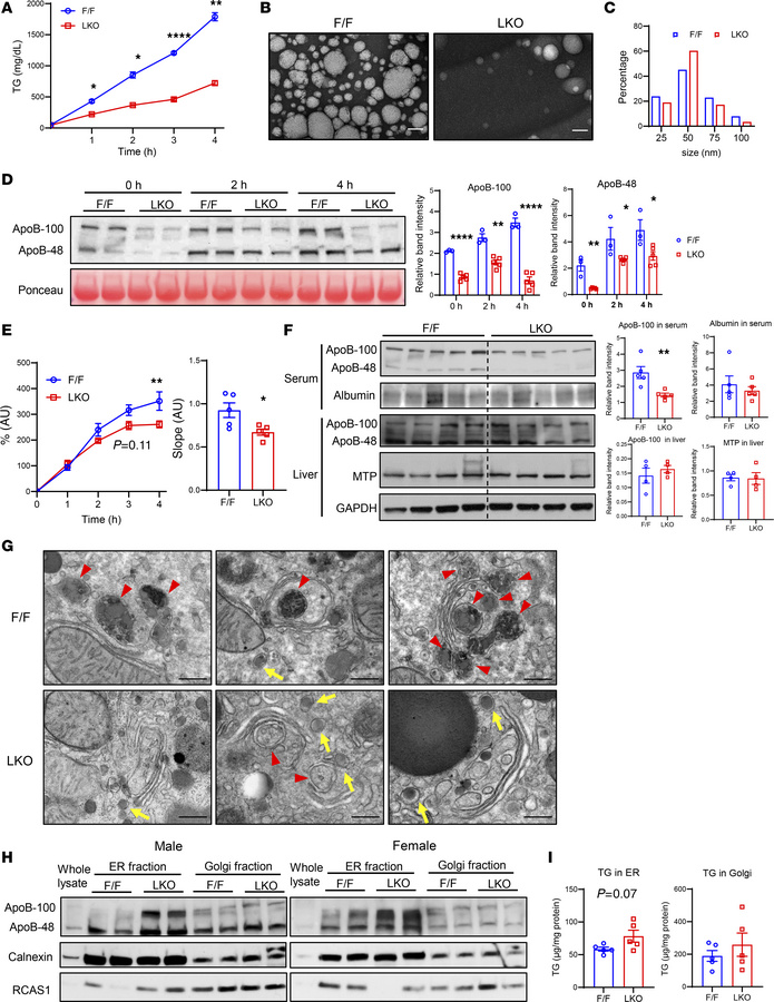 Hepatic Sec16b deficiency impairs ApoB lipidation and VLDL secretion.
(A...