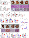 Loss of Sec16b reduces serum lipids and leads to hepatic lipid accumulation