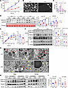 Hepatic Sec16b deficiency impairs ApoB lipidation and VLDL secretion.
