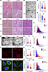 SEC16B controls LD expansion in the liver.