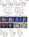 Whole-body Sec16b knockout protects against hyperlipidemia and atherosclero