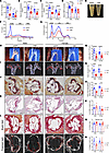 Hepatic Sec16b deficiency ameliorates hyperlipidemia and atherosclerosis in