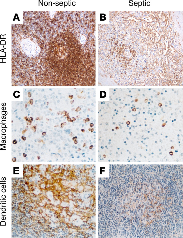 IHC staining of spleens from nonseptic or septic patients showing decrea...
