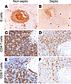 IHC staining of spleens from nonseptic or septic patients showing profound