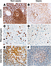 IHC staining of spleens from nonseptic or septic patients showing decrease