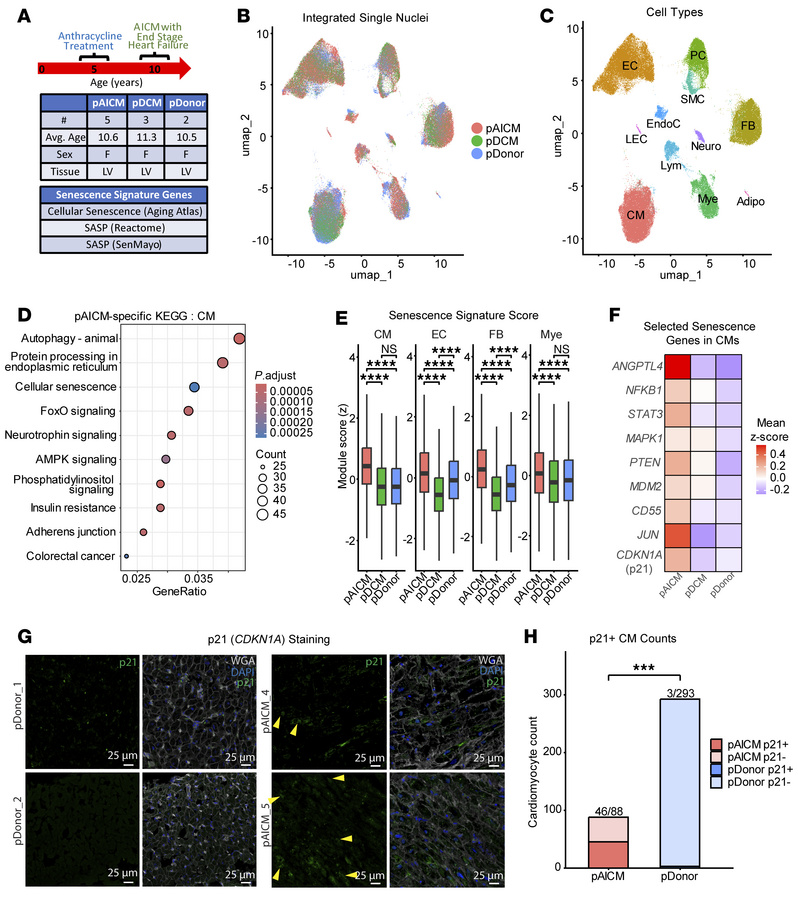 Cellular senescence in pediatric anthracycline-induced cardiomyopathy.
(...