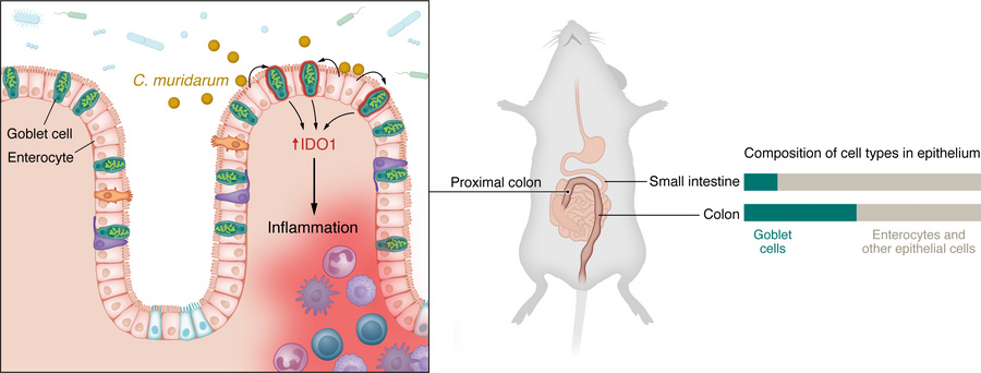 Microbial drivers of region-specific intestinal inflammation.
Spencer et...