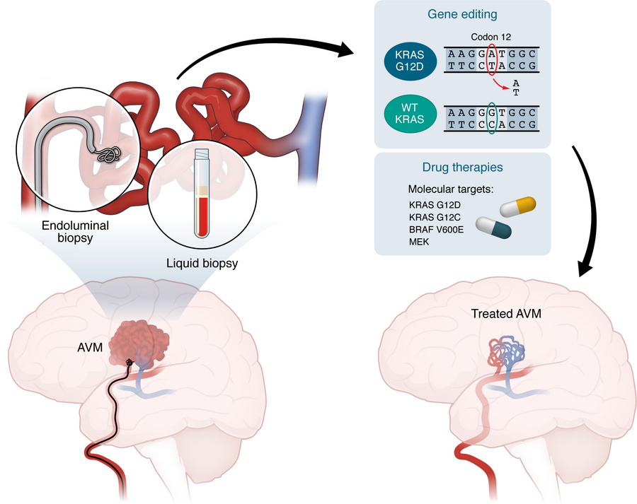 Integrated clinical-genomic framework for precision medicine in bAVMs.
M...