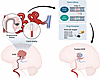 Integrated clinical-genomic framework for precision medicine in bAVMs.