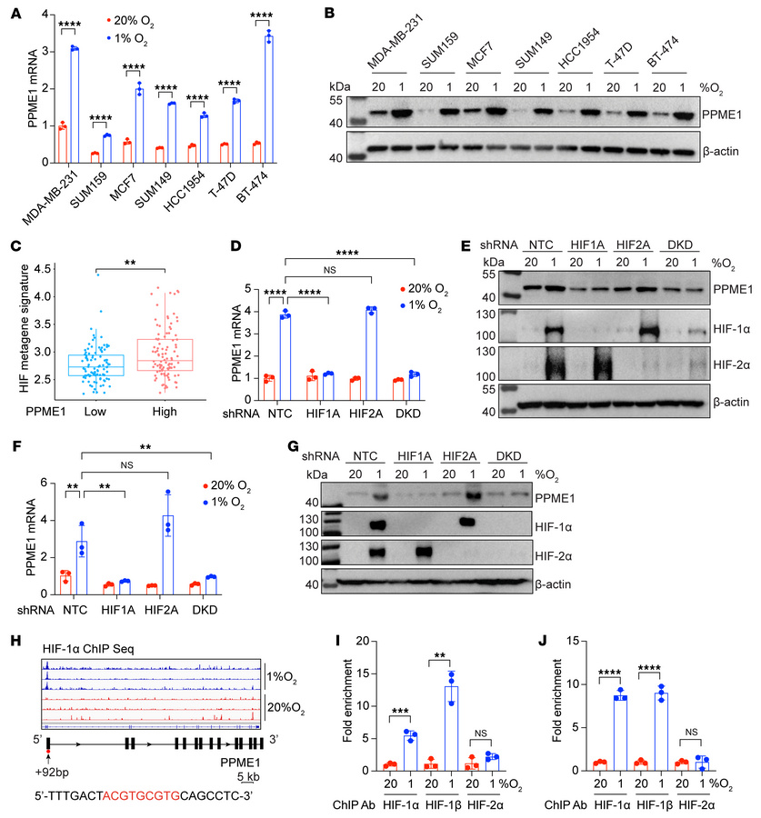PPME1 expression is mediated by HIF-1 in hypoxic BC cells.
(A) Human BC ...