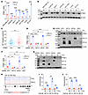PPME1 expression is mediated by HIF-1 in hypoxic BC cells.
