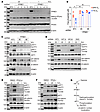 PPME1 promotes nuclear localization of β-catenin in BC cells by enhancing A
