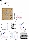 PPME1 is required for hypoxia-induced BCSC specification.