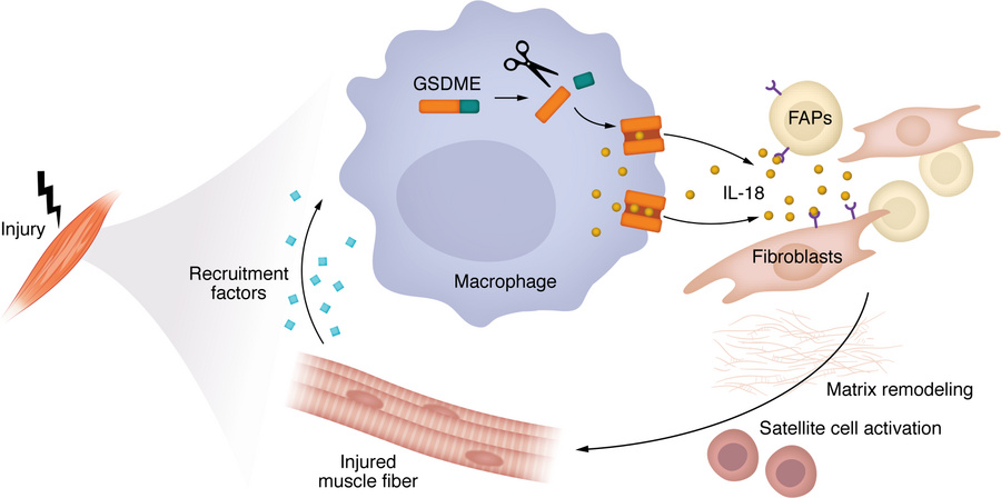 Myeloid cell GSDME expression coordinates skeletal muscle repair by faci...