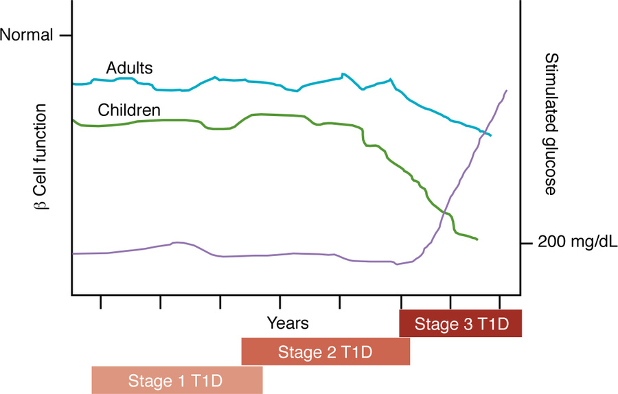 Progression of β cell loss in T1D.
The progression from the first discov...