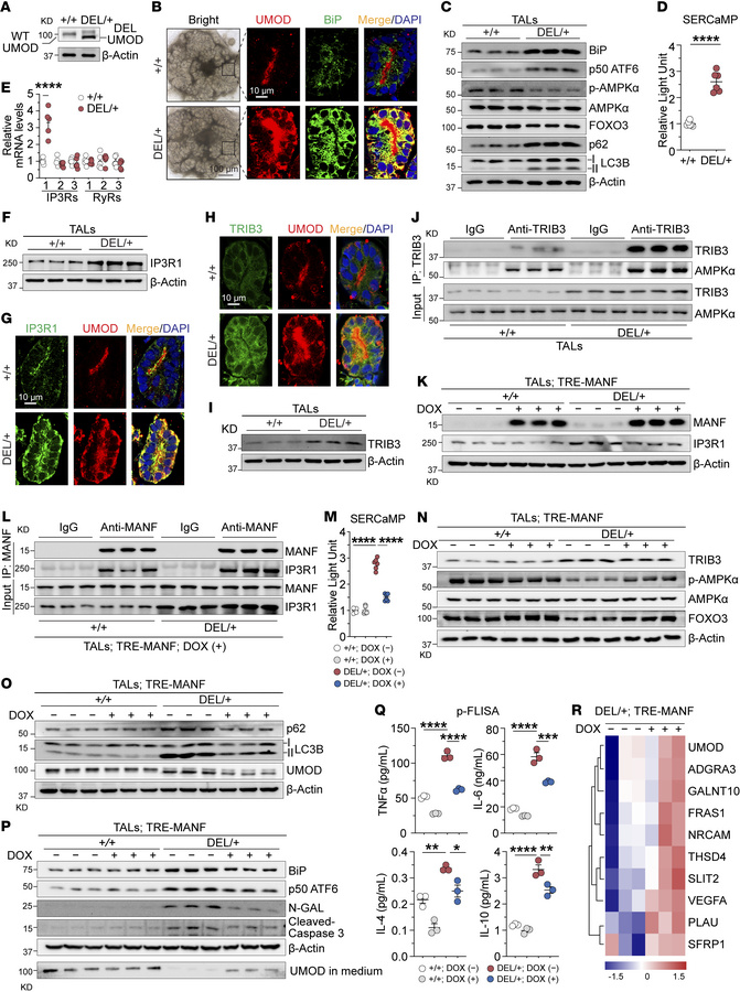 MANF promotes UMOD proteostasis by regulating IP3R1-mediated ER calcium ...