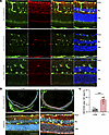 Retinal localization and quantification of ISG15+ Müller-associated signals