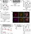 ISG15/ISGylation promotes proteasome-dependent degradation of PRDX6 in Müll