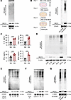 Microglia-derived IFN-β induces ISG15 expression and ISGylation in Müller g