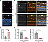 Microglia-derived IFN-β promotes Müller-associated ISG15 induction in diabe