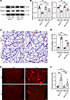 Müller glia–specific ISG15 deletion preserves retinal vascular barrier inte