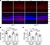 Müller glia–specific ISG15 deletion attenuates diabetes-induced retinal oxi