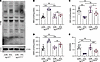Müller glia–specific ISG15 deletion attenuates retinal lipid peroxidation a