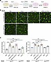 ISG15/ISGylation in Müller glia promotes endothelial tube formation in vitr
