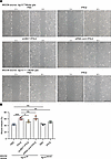 ISG15/ISGylation in Müller glia promotes endothelial migration in vitro.