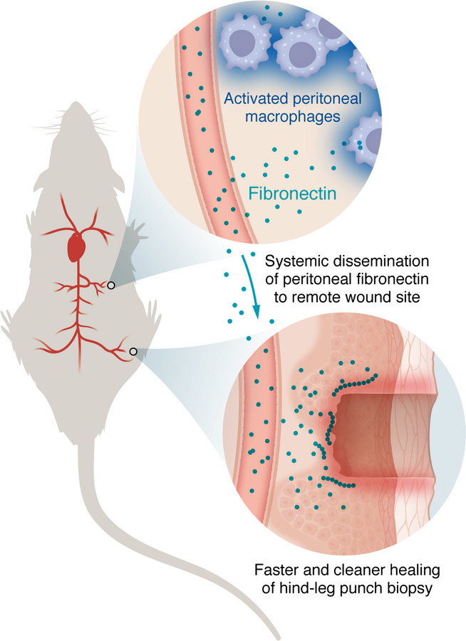 Activated peritoneal macrophages produce fibronectin to accelerate dista...